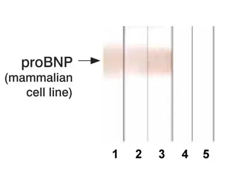 Detection of human recombinant proBNP expressed mammalian cells in Western blotting by different monoclonal antibodies after Tricine-SDS gel electrophoresis.